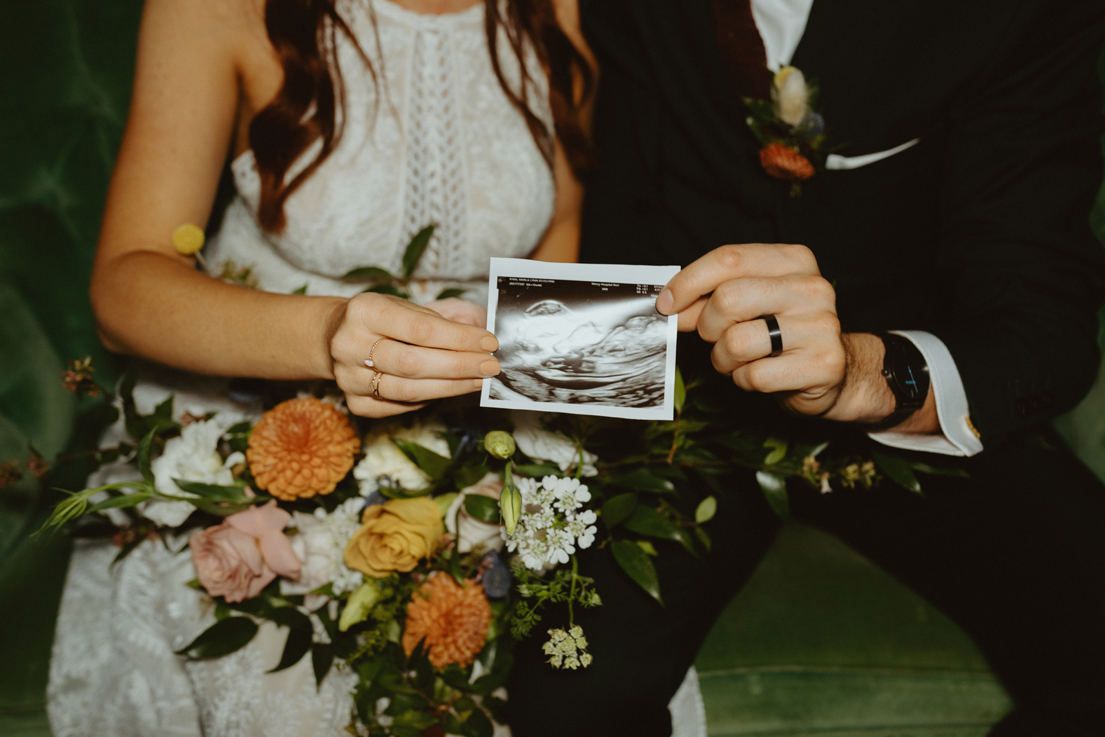 Close up photo of the bride and groom's sonogram.